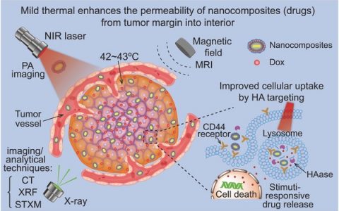 Adv. Mater. 钆杂化等离子体金纳米复合体增强多模式造影导向治疗中的肿瘤内部药物渗透