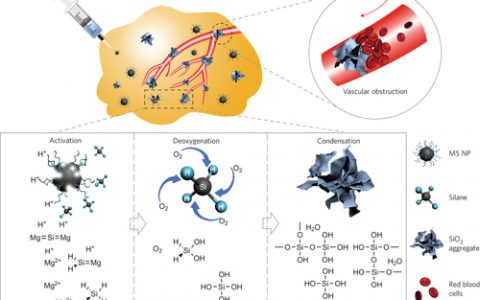 Nature子刊:硅化镁纳米粒作为脱氧剂用于肿瘤饥饿疗法