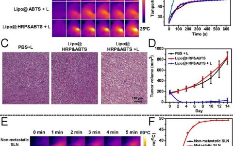 PNAS:过氧化氢响应性脂质体纳米探针通过体内显色测定用于光声炎症成像和肿瘤诊疗