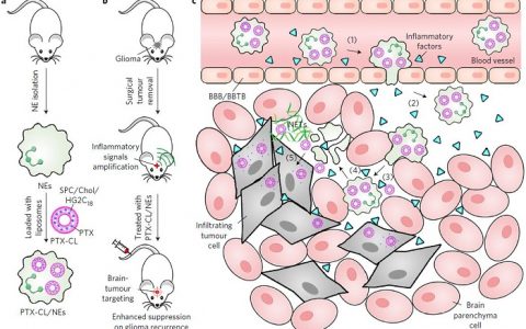 中国药科大学张灿团队Nature Nanotechnology:利用免疫细胞递送药物抑制脑胶质瘤的术后复发