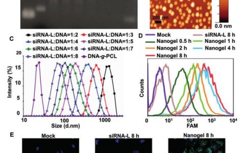 上海交大Angew. Chem. Int. Ed.:交联的核酸纳米凝胶用于有效的siRNA递送和抗肿瘤治疗