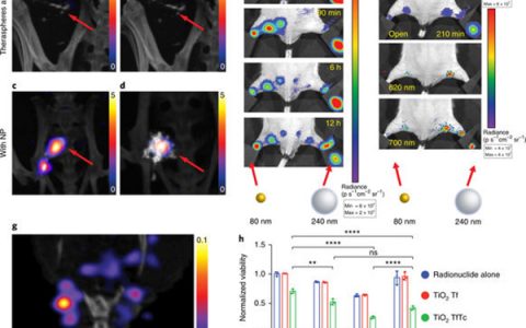 美国康奈尔大学Nat. Nanotechnol.：纳米粒子作为电离辐射的多模态光子传感器